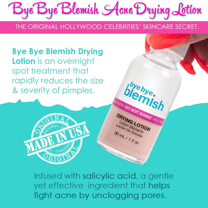 Acne Drying Lotion, Reduce Pimples Overnight 1oz, 1-Pack