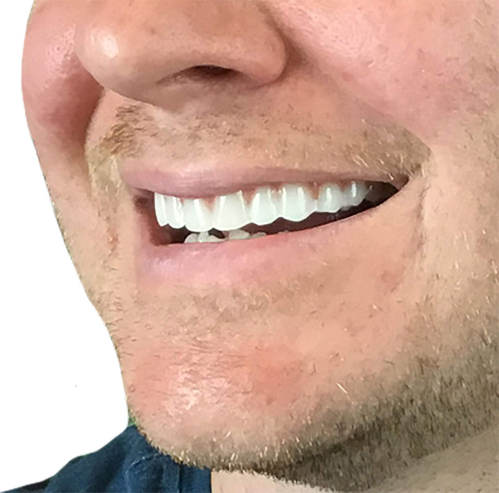 Comfort Fit Flex - Natural Shade - Upper Veneer Cosmetic Teeth