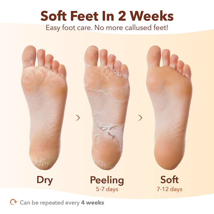 Exfoliating Foot Mask (3 Pack) – Regular Size Exfoliating Foot Masks for Cracked Feet, Dry Skin, Callused Feet…