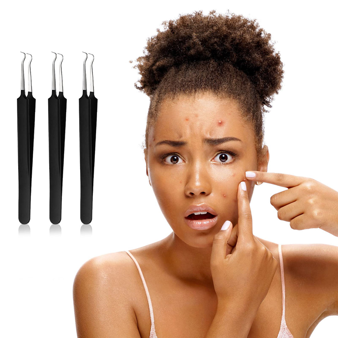 3 Pieces Blackhead Tweezers Blemish Stainless Steel Blemish Extractor Tool for Remove Blackhead Whitehead Pimple Bend Curved Tweezer Skin Blackhead Remover Tools (Black)