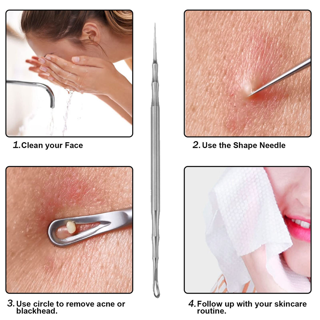 Pointed Blackhead Removal, 2-in-1 Acne Extractor Tool - Stainless Steel Whitehead Remover for Face/Nose
