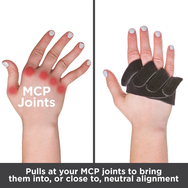 Ulnar Deviation & Drift Hand Splint | MCP Knuckle Joint Support Brace for Rheumatoid Arthritis & Tendonitis Pain Relief, Finger Straightener & Stretcher Glove - L (MED/LGE) Right
