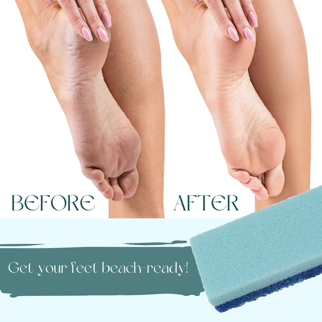 Foot Scrubber Pumice Stone for Feet- Foot Scrubbers for Use in Shower and Foot Tub- Pedicure Supplies Feet Scrubber for Dead Skin- Double Sided Foot Scrubber Dead Skin Remover- 4 Pack