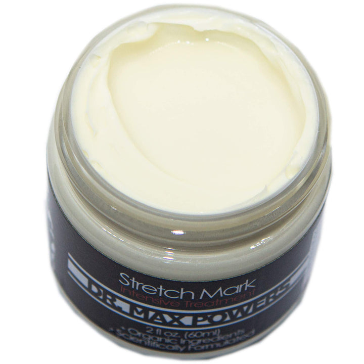 Dr. Max Stretch Mark Cream - Intensive, 2oz