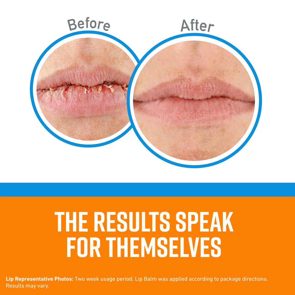 Cooling Relief Lip Repair Lip Balm for Dry, Cracked Lips, Stick, (Pack of 2)