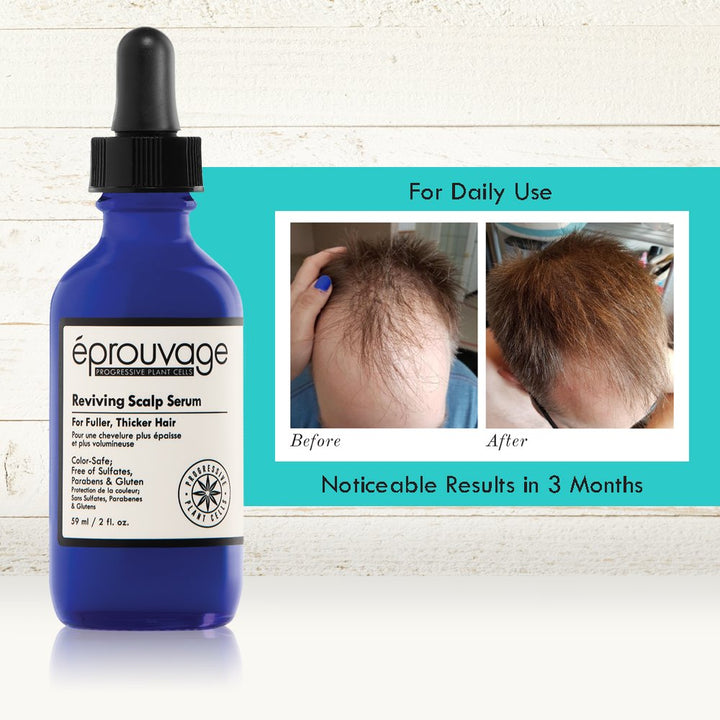 Éprouvage Reviving Scalp Serum – For Thicker, Fuller Hair – Thinning Hair, Hair Loss Treatment – 2 Fl. Oz.