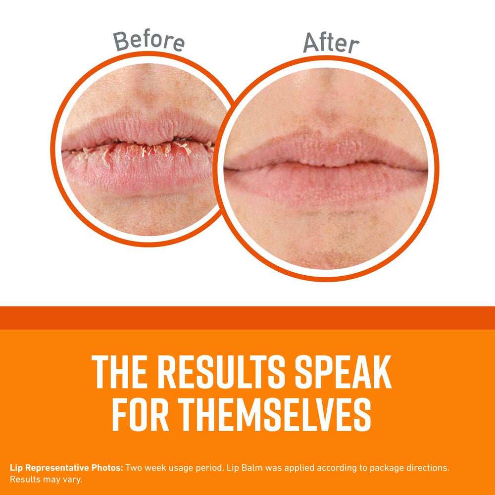 Unscented Lip Repair Lip Balm for Dry, Cracked Lips, Stick, (Pack of 6)
