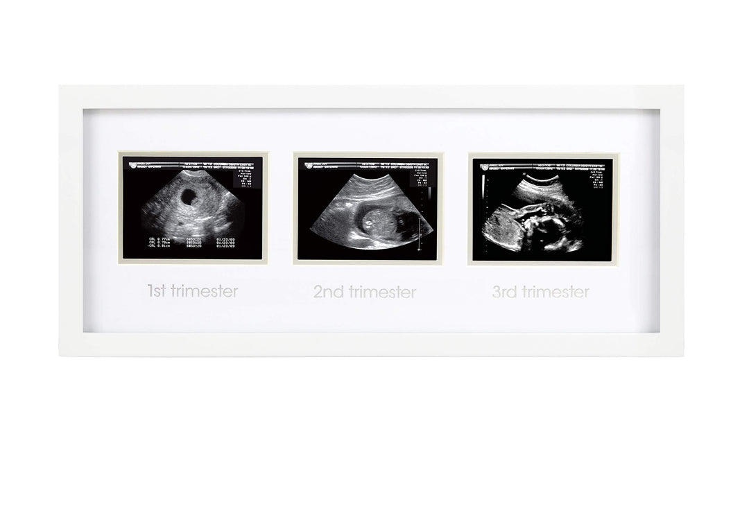 Sonogram Progression Frame - Trimester by Trimester Pregnancy Milestone Keepsake, Gender-Neutral Nursery Decor, Displays 1st, 2nd & 3rd Trimester Ultrasound Photos, White