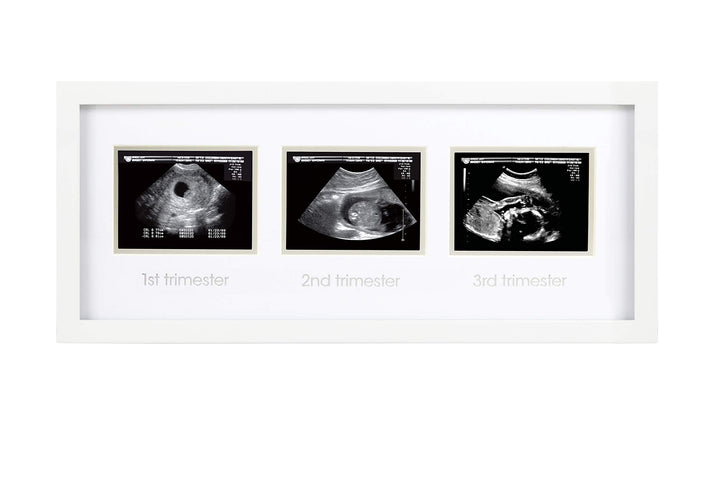 Sonogram Progression Frame - Trimester by Trimester Pregnancy Milestone Keepsake, Gender-Neutral Nursery Decor, Displays 1st, 2nd & 3rd Trimester Ultrasound Photos, White