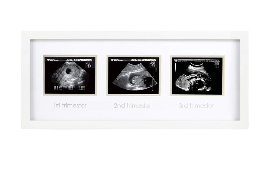 Sonogram Progression Frame - Trimester by Trimester Pregnancy Milestone Keepsake, Gender-Neutral Nursery Decor, Displays 1st, 2nd & 3rd Trimester Ultrasound Photos, White