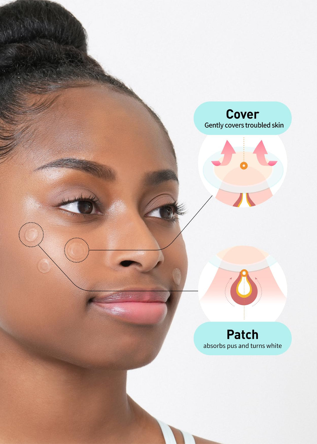 Care Plus Spot Patch Big (81 Count) | Hydrocolloid Patch, Spot Stickers for Acne Pimple Blemishes and Zits