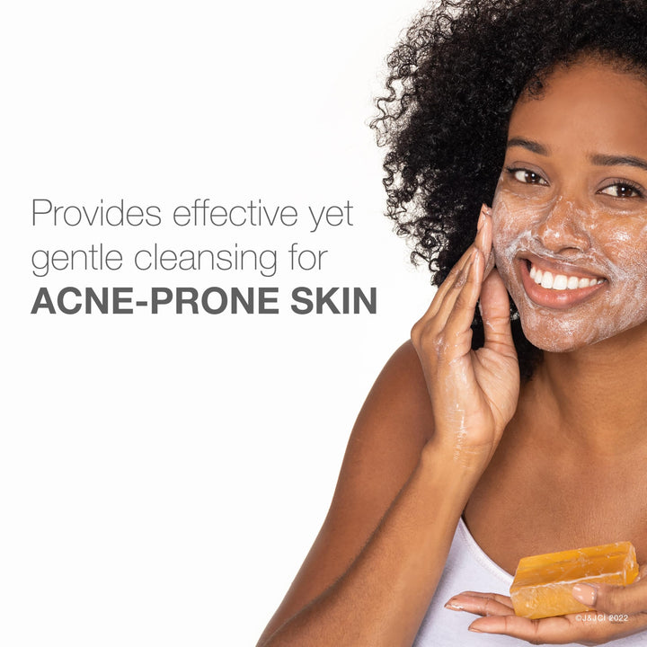 Facial Cleansing Bar Treatment for Acne-Prone Skin, Non-Medicated & Glycerin-Rich Formula Gently Cleanses without Over-Drying, No Detergents or Dyes, Non-Comedogenic, 3.5 oz