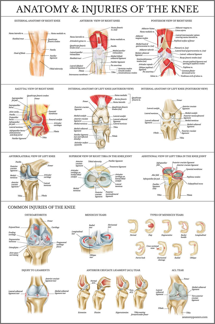 Laminated Anatomy and Injuries of the Knee Poster - Knee Joint Anatomical Chart - 18 x 24