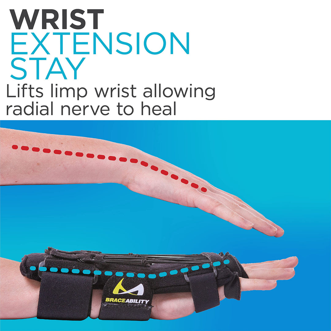 Radial Nerve Palsy Splint - Dynamic Wrist Drop Splint for Limp Finger Wrist Extension, Saturday Night, Honeymoon, Crutch Palsy, Stroke Recovery Brace - Fits Right or Left Hand (One Size)
