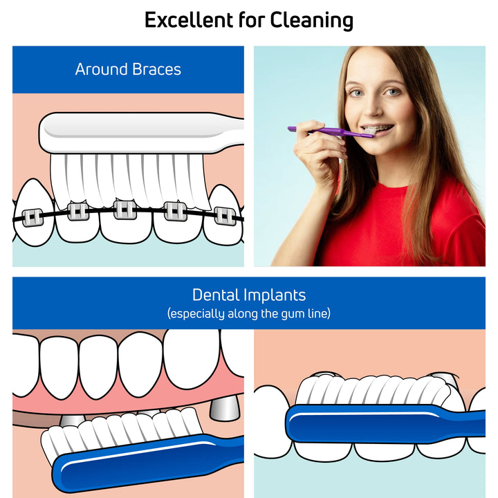 Implant/Orthodontic Brush