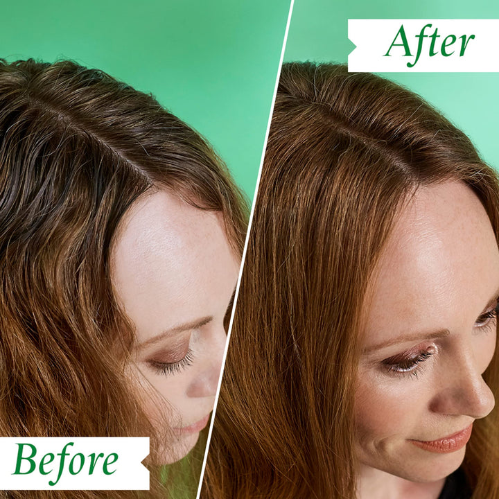 Philip Kingsley Flaky Scalp Shampoo, 8.45 Ounce