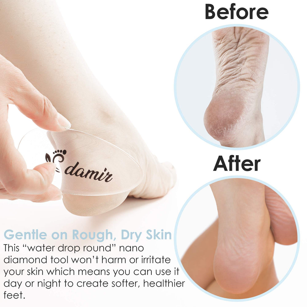 Glass Dry Heel Buffer Foot File - Professional Rasp Corn Callus Remover - Pedicure Feet Diamond Wash Scrubber Surface Tool Treatment For Peels Dead Cracked Rough Skin Heels