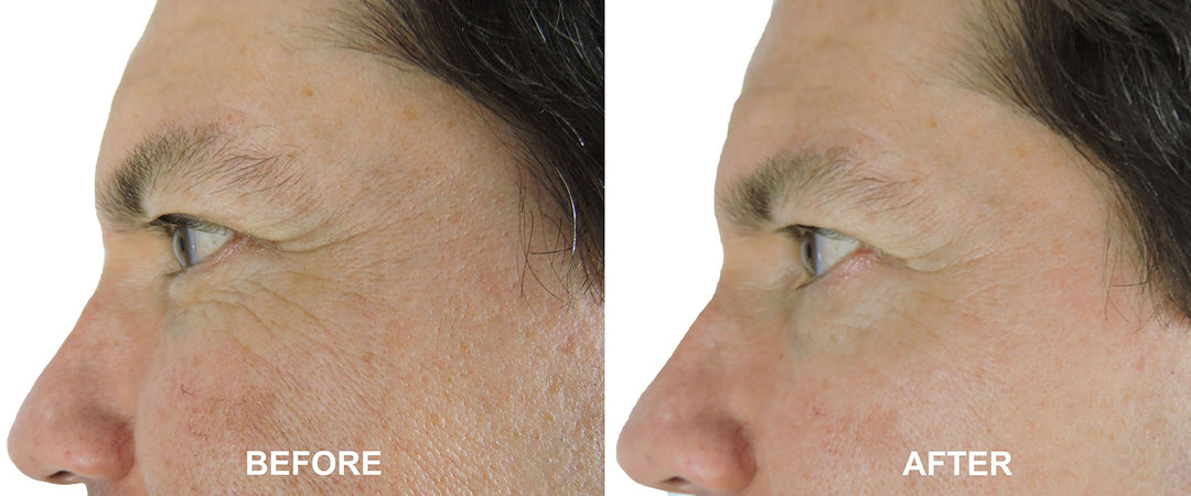 Magic Night Cream-No Needle Alternative-Pure Argireline Peptides Overnight Firming Cream-Argireline, Matrixyl 3000, SNAP-8, Pentapeptide-18 (Leuphasyl), SYN-AKE, Copper Peptide,Syn-Coll, Syn-Tacks