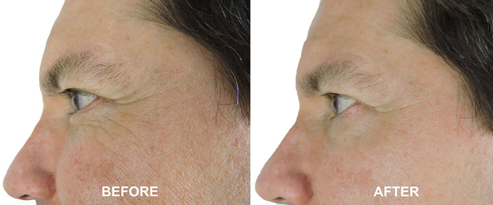 Magic Night Cream-No Needle Alternative-Pure Argireline Peptides Overnight Firming Cream-Argireline, Matrixyl 3000, SNAP-8, Pentapeptide-18 (Leuphasyl), SYN-AKE, Copper Peptide,Syn-Coll, Syn-Tacks
