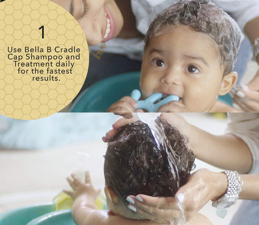 Cradle Cap Shampoo & Treatment - Baby Shampoo and Conditioner for Dry Scalp