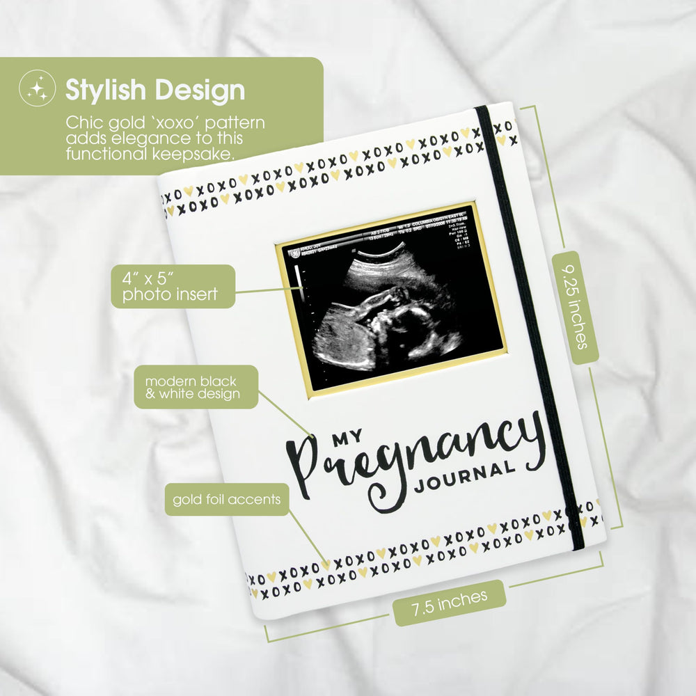 My Pregnancy Journal - 74-Page Memory Book and Photo Album, Gender Neutral Planner for Expecting Moms, Includes Milestone Sections and Ultrasound Photo Insert