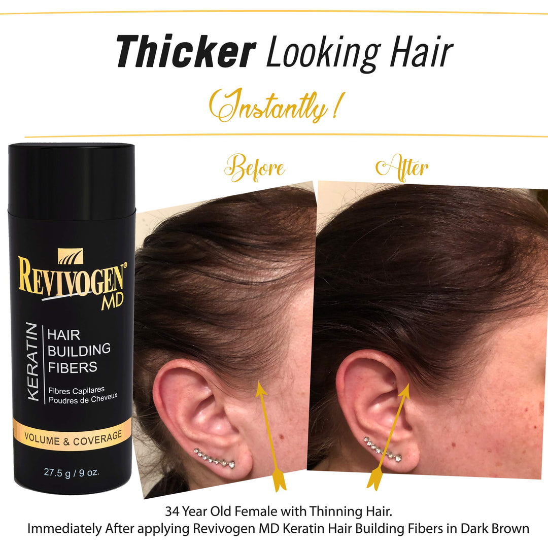 MD Keratin Hair Building Fibers, Black, Unscented, 0.9 oz.