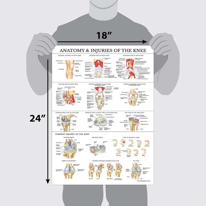 Laminated Anatomy and Injuries of the Knee Poster - Knee Joint Anatomical Chart - 18 x 24