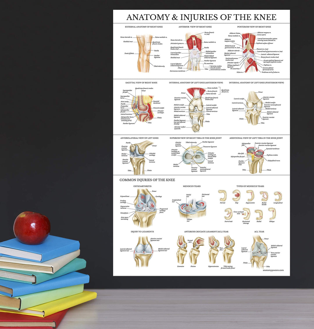 Laminated Anatomy and Injuries of the Knee Poster - Knee Joint Anatomical Chart - 18 x 24