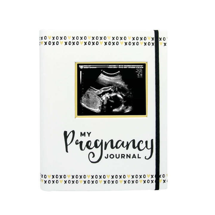My Pregnancy Journal - 74-Page Memory Book and Photo Album, Gender Neutral Planner for Expecting Moms, Includes Milestone Sections and Ultrasound Photo Insert
