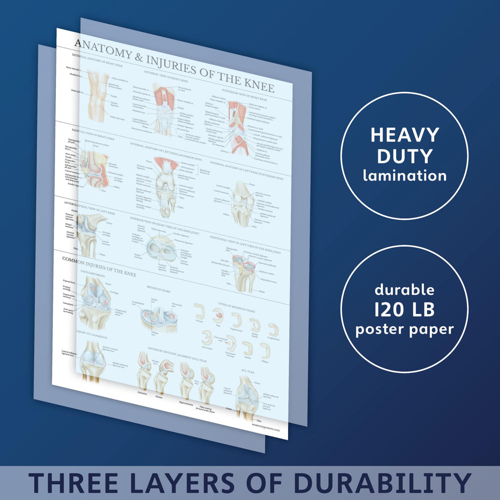 Laminated Anatomy and Injuries of the Knee Poster - Knee Joint Anatomical Chart - 18 x 24