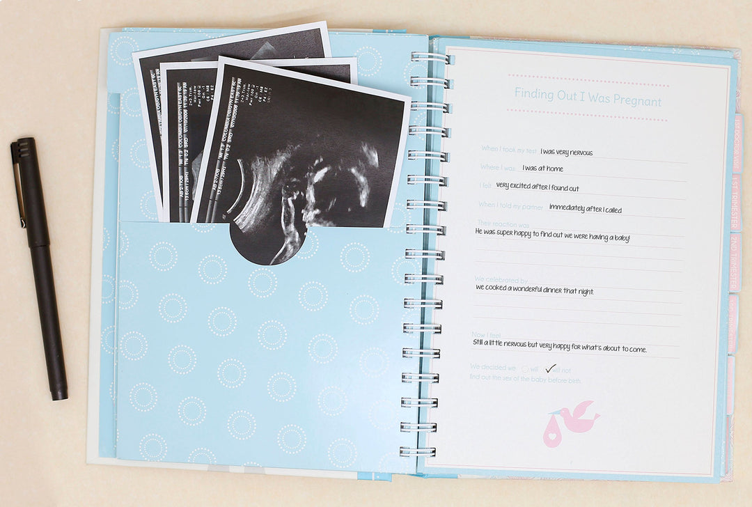 My Pregnancy Journal, Pregnancy Book, Capture Every Precious Moment of Your Pregnancy, Gift for New Mom