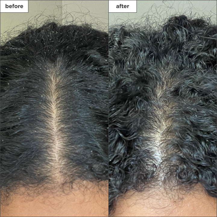 Scalp Revival Charcoal + Coconut Oil Micro-Exfoliating Shampoo, Treatment for Dry & Itchy Scalp, Clarifying Shampoo for Build Up, Scalp Scrub for Oily Scalp, Vegan, Cruelty-Free, 8 fl oz