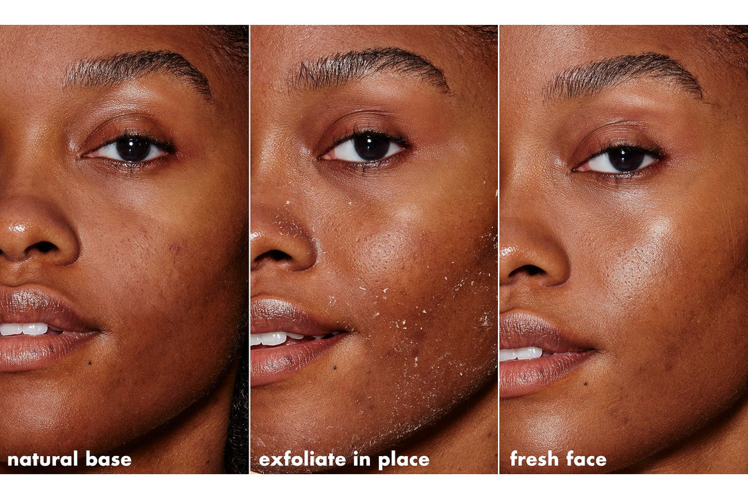 SKIN Gentle Peeling Exfoliant, Cleanser, Effective, Easy to Apply, Peels Away Dead Skin, Removes Dirt, Ideal for All Skin Types