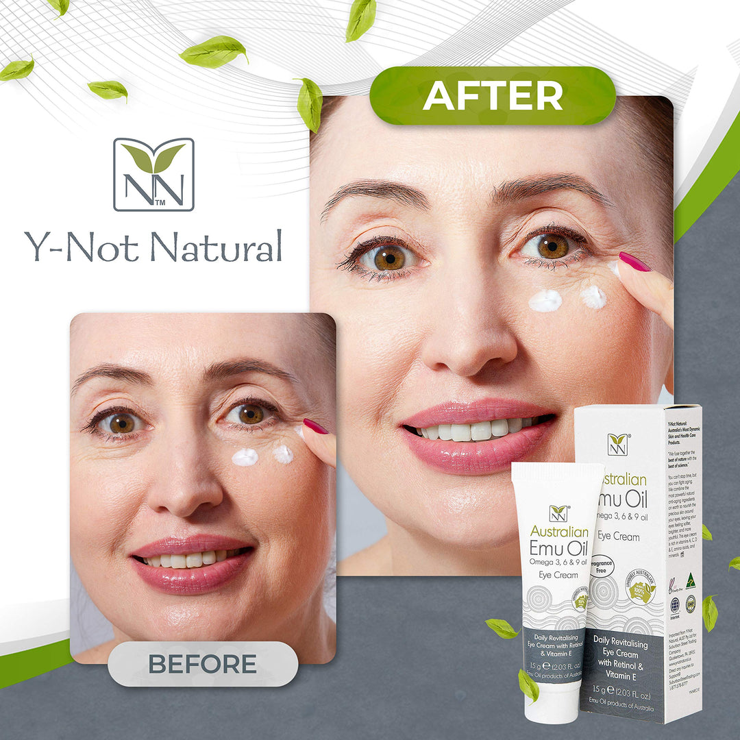 Y-Not Natural - Emu Oil Daily Revitalizing Eye Cream with Retinol, Vitamin E, A, C & D (15 g Tube) | SPF 15 Sun Protection Anti Aging Facial Skin Care to Reduce Puffiness, Fine Lines & Dark Spots