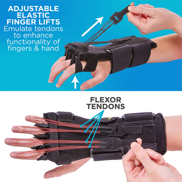 Radial Nerve Palsy Splint - Dynamic Wrist Drop Splint for Limp Finger Wrist Extension, Saturday Night, Honeymoon, Crutch Palsy, Stroke Recovery Brace - Fits Right or Left Hand (One Size)