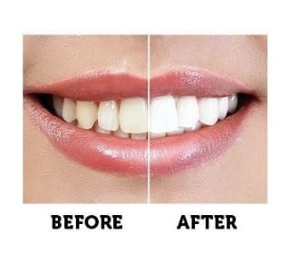 Activated Charcoal Teeth Whitening Black Powder Toothpaste Best Natural 100% Organic White Teeth Whitener Bleach Carbon Fluoride Free Products Kit Cleaner Bright Wow Smile Bamboo No More Dental Strips