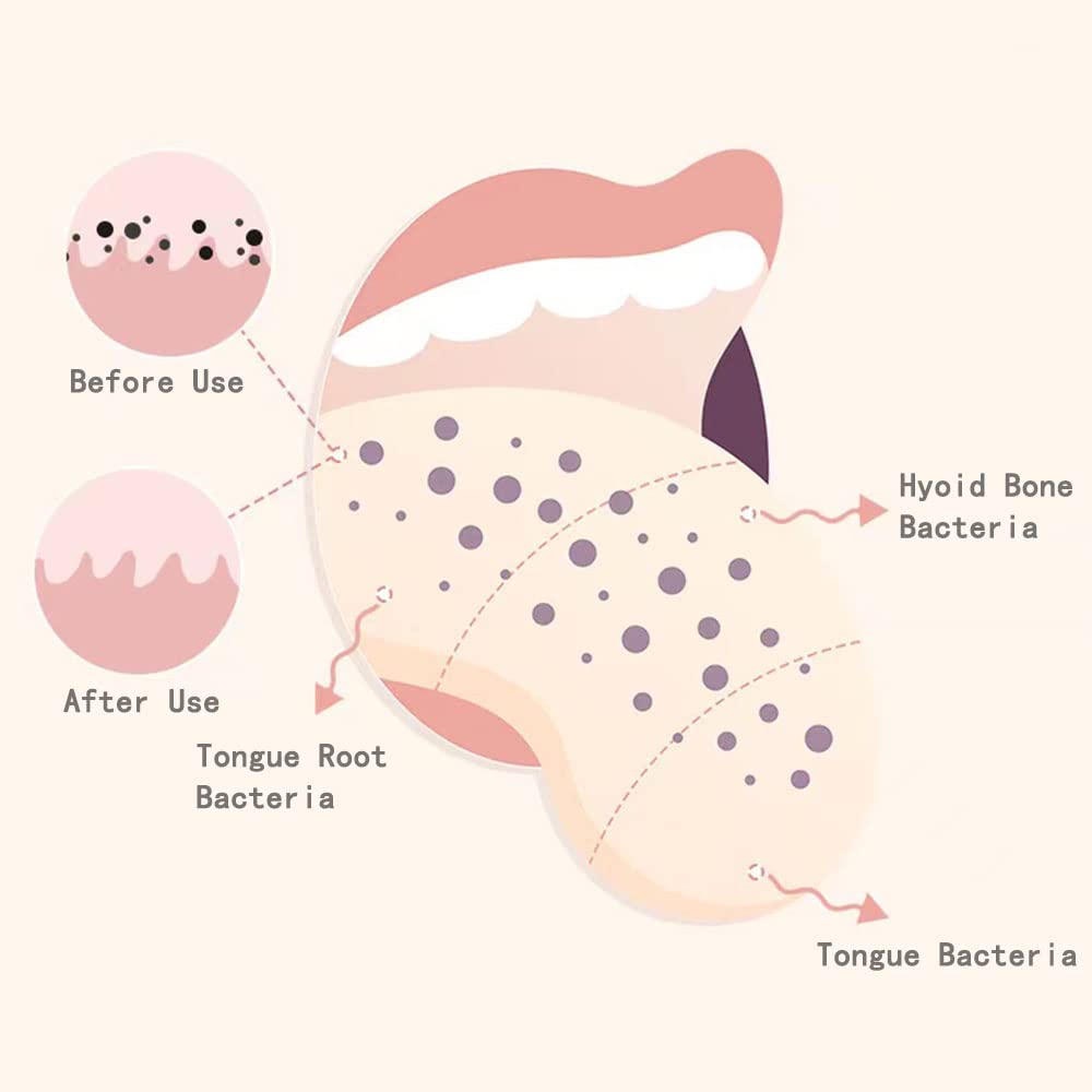 PIVHWIR 4-Pack Tongue Scrapers, Tounge Scraper Cleaner 