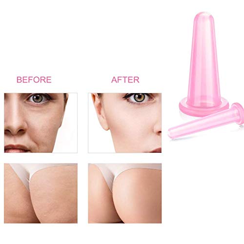 4Pcs Cupping Facial Set for Face and Eye Cupping Massage, Facial Cupping Set Silicone Cups with Exfoliating Brush for Face Neck Skin (2 Small&amp;2 Large, Pink)