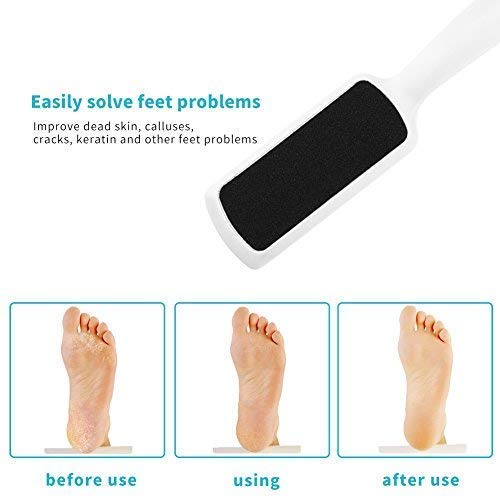 CAPSPACE 3 Pieces: Pedicurefootraspfile Callusremover, Double-Sided Colossal Foot Rasp Foot File And Callus Remover For Dead Skin (Pack Of 3)
