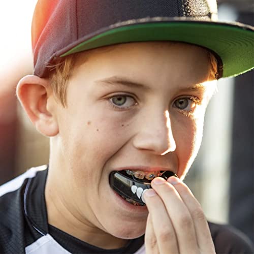 Shock Doctor Mouth Guard for Braces for Sports, Orthodontic Mouth Guard for Braces, Upper & Lower Mouthguard, Mouth Guard for Lacrosse, Hockey, Baseball, Football, Braces Mouth Guard