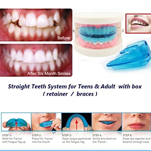 Dental Mouth Guard Bruxism Nighttime Sleep Mouth Grindi