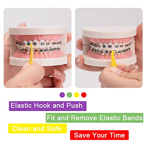 20 Pack Dental Elastic Rubber Bands Placers for Braces 