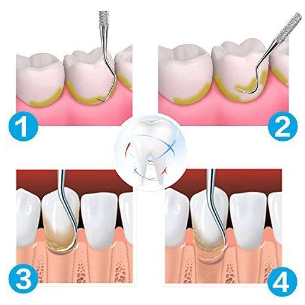 Dental Tools with Pick and Scaler Kit for Plaque Remova