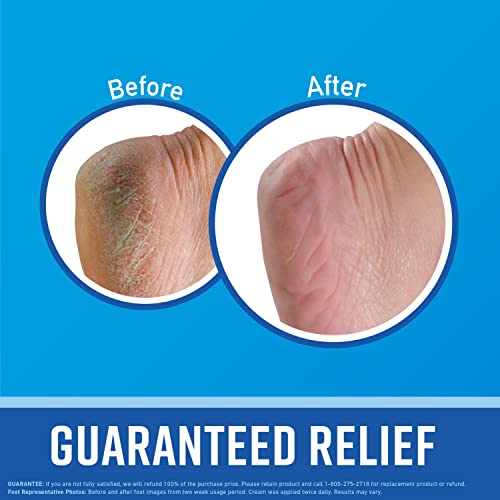 O&#39;Keeffe&#39;s for Healthy Feet Foot Cream; Guaranteed Relief for Extremely Dry; Cracked Feet; Instantly Boosts Moisture Levels; 3.2 Ounce Jar; (Pack of 1)