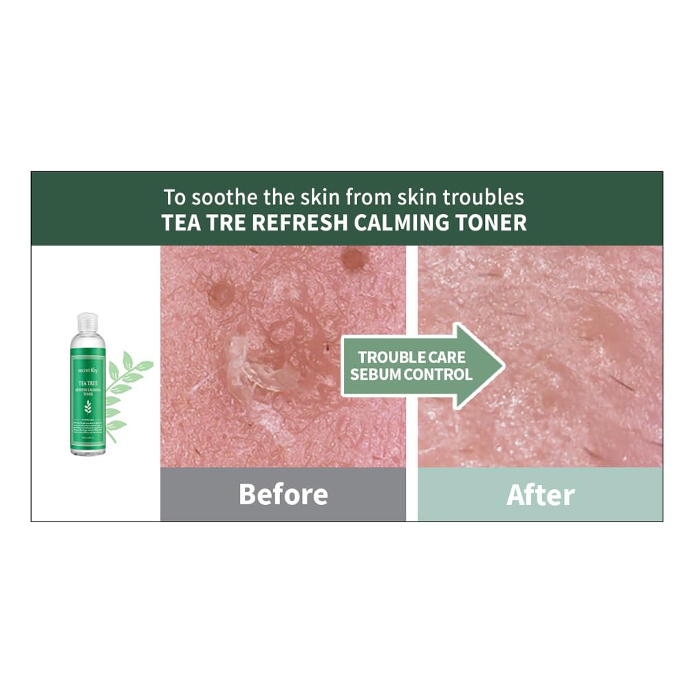 Secret Key - Tea Tree Refresh Calming Toner - Facial Care
