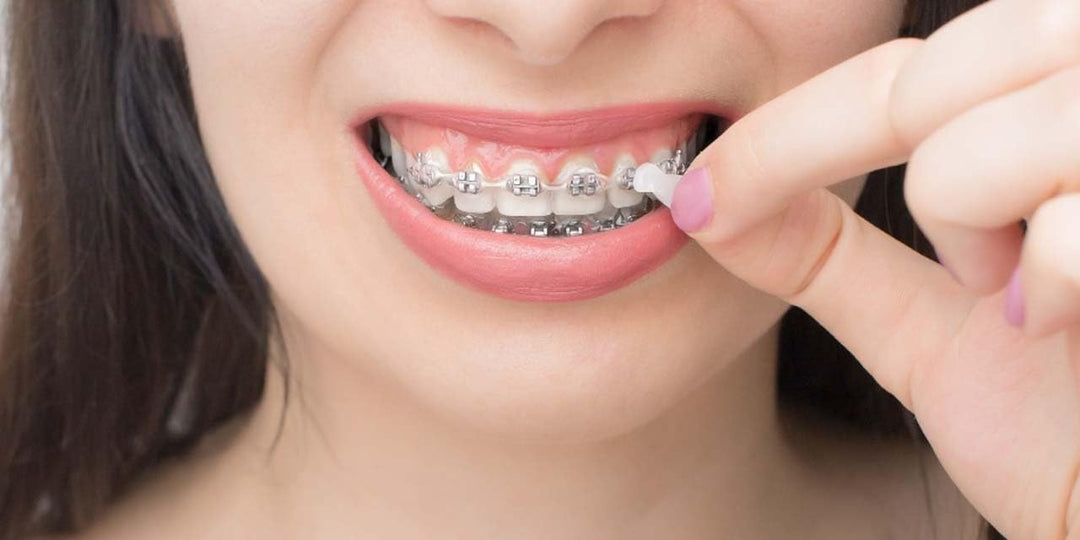 Genuine Orthowax - Our Bestseller Orthodontic Wax For B