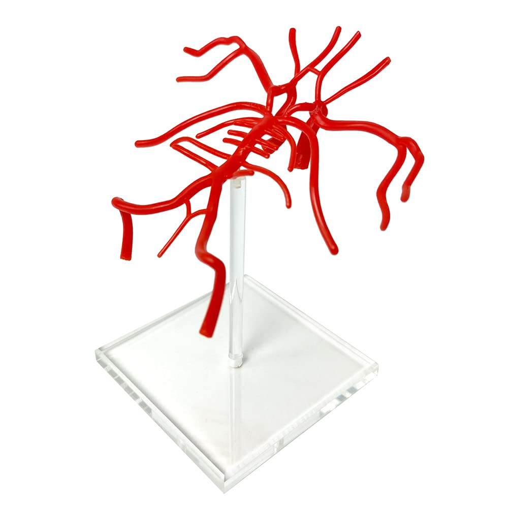 Evotech Brain Artery Model, Life Size Intracranial Arte