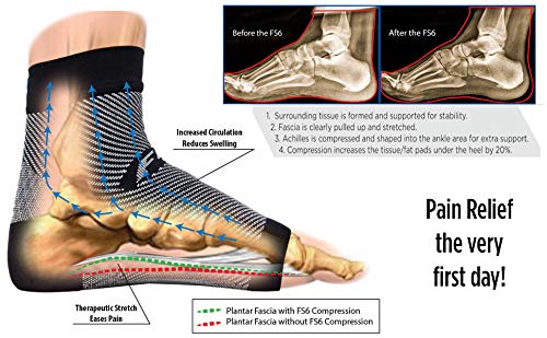 OrthoSleeve FS6 Compression Foot Sleeve - Orthopedic Br