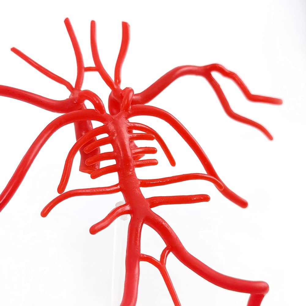 Evotech Brain Artery Model, Life Size Intracranial Arte