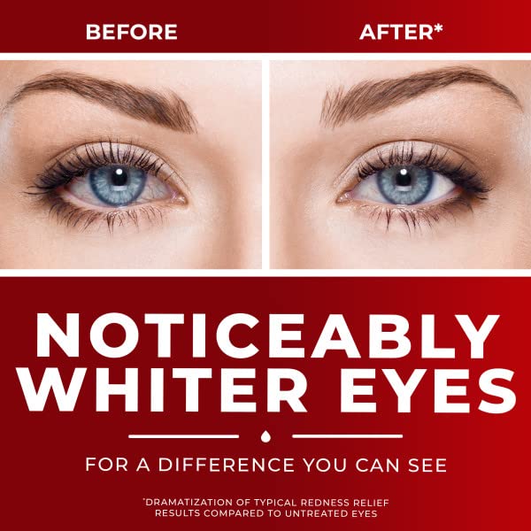 Clear Eyes Maximum Strength Redness Relief Eye Drops, 2